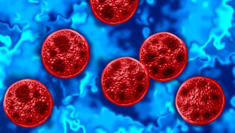 Cyclosporiasis outbreak